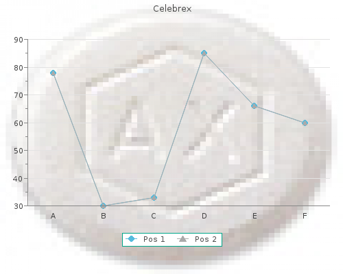 cheap celebrex 200mg with visa